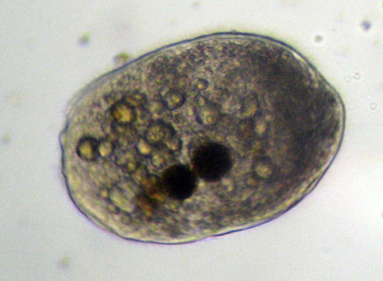 Tre Protozoi da identificare (se possibile)